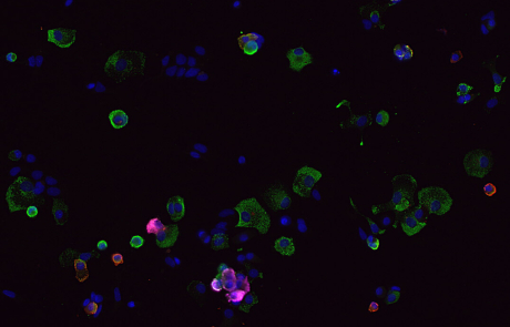 Blog Main James Lab T1D Beta Stem Cells