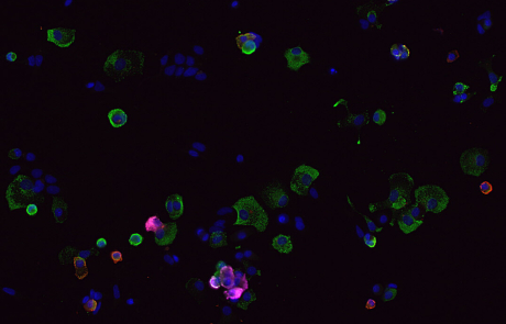 Blog Main Image -  James Lab T1D Beta Stem Cells