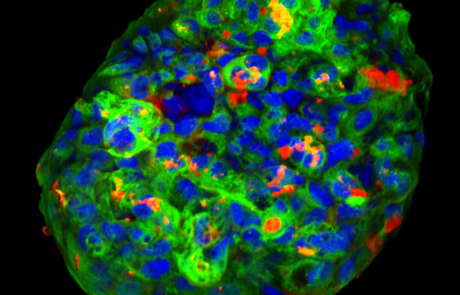 Blog Scientific T1D Islet Organoid