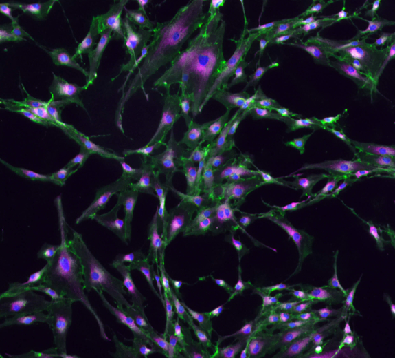 Purple shows the cell's mitochondria, green colors the cell membranes, and blue is the nucleus. Imaged by Mitch Fahning.
