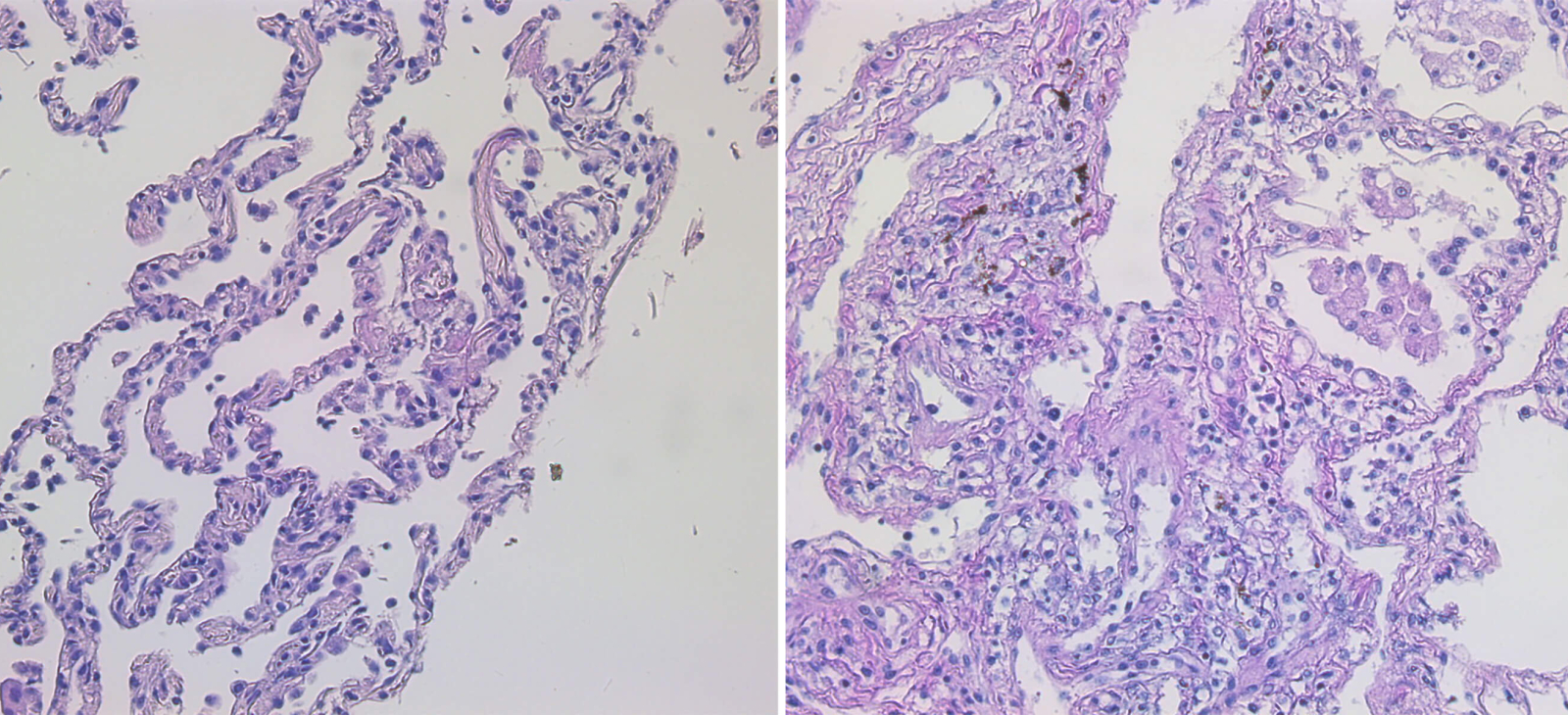 Mikacenic Research Project Full-Width - Macrophage Heterogeneity