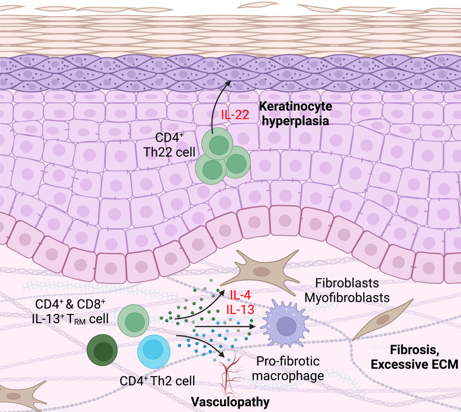 Morawski Res Proj Inline - Skin T Cells Structure