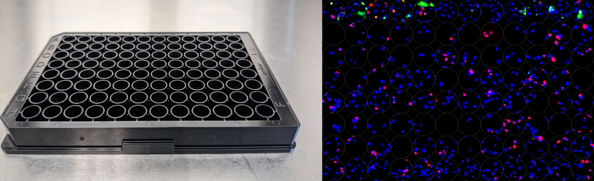Revolutionary Microscope to Fuel Immunology Breakthroughs | Benaroya ...