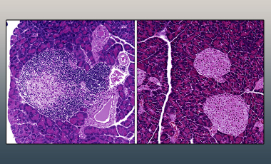 Campbell Lab Research Project Preview - IL-2 Mutein Therapy