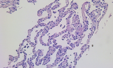 Mikacenic Res Proj Prev - Macrophage Heterogeneity