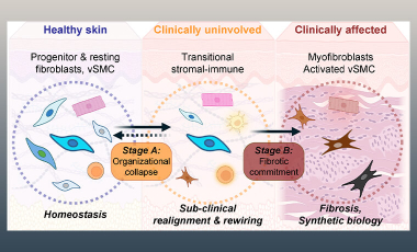 Morawski Lab Research Project Preview - Early Fibroblast Dysregulation in Scleroderma