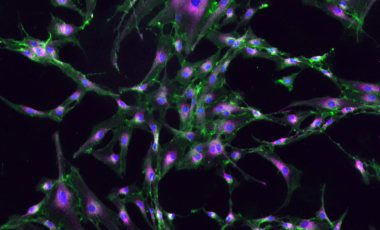 Purple shows the cell's mitochondria, green colors the cell membranes, and blue is the nucleus. Imaged by Mitch Fahning.